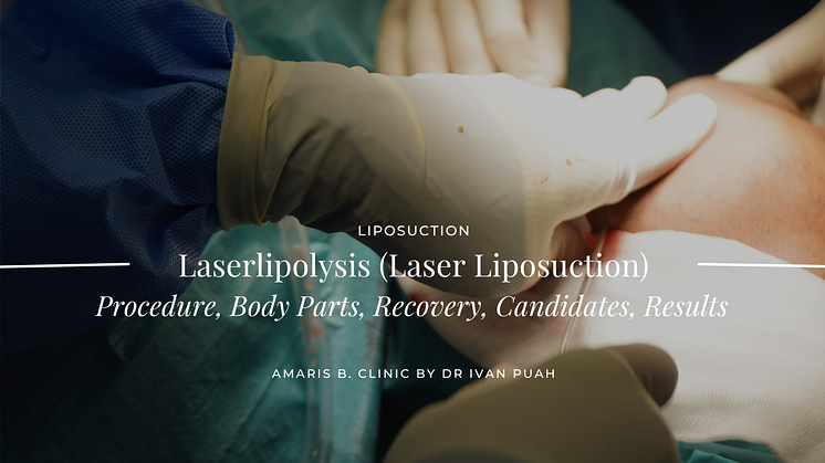 ⁠Laserlipolysis (Laser Liposuction): Procedure, Body Parts, Recovery, Candidates, Results