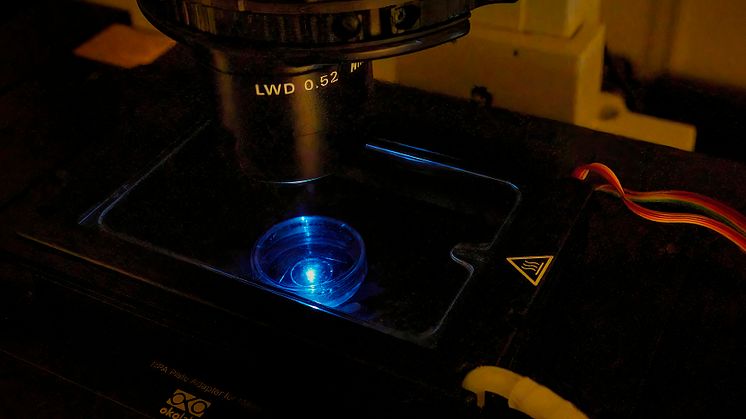 Fluorescensavbildning av levande celler i ett konfokalmikroskop.jpeg