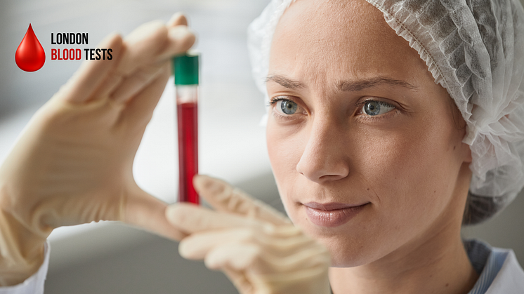 London Blood Tests offers Cancer Antigen Testing in over 100+ UK locations. Book Now!