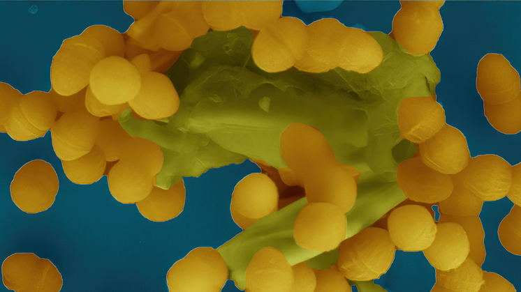 Image from an electron microscope showing how Enterococcus faecalis bacteria clump together to share, among other things, antibiotic resistance with each other.