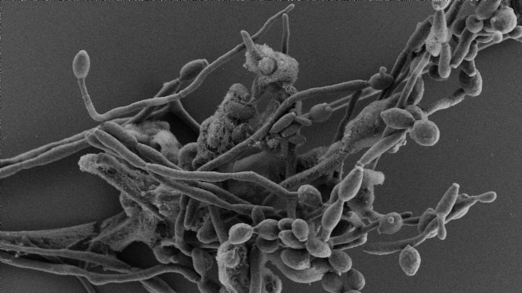 Candida albicans interagerar med neutrofiler i en extremt syrefattig miljö, där neutrofilerna som annars är kroppens försvar mot svampen, får kraftigt försämrad funktion. Foto: Umeå Core Facility for Electron Microscopy.