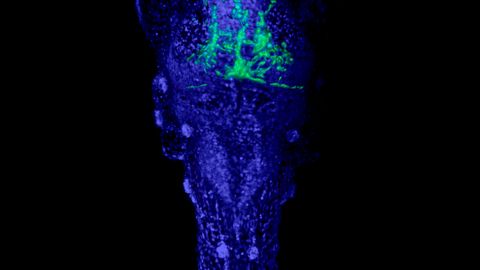Bilden föreställer ett zebrafiskyngel med cancerceller (gröna) i nervsystemet. Forskarna använde denna typ av djurmodell för att utvärdera nya behandlingar.  Bild: Elin Almstedt