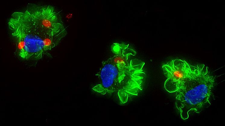 Toxoplasma_Antonio Barragan