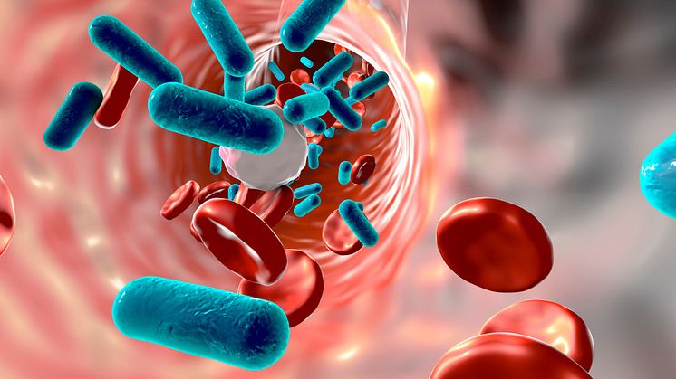 Stopping Sepsis in its Tracks