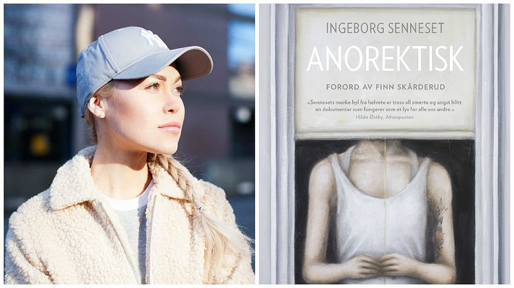 "Hjerteskjærende innsiktsfullt, nådeløst selvutleverende, og strålende skrevet om å lide av anoreksi", skriver anmelder Fartein Horgar i sin omtale av Anorektisk. 