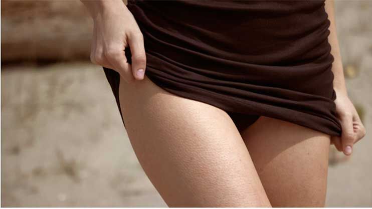 Excess fat in your thighs causing skin issues and affecting your sartorial choices? This could be the most effective way to tone up your lower body