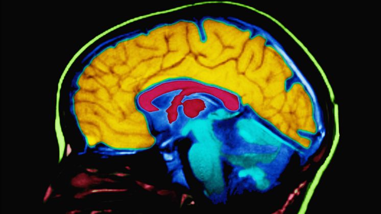 NHS Atlas of Variation in Healthcare launches - the Stroke Association comments