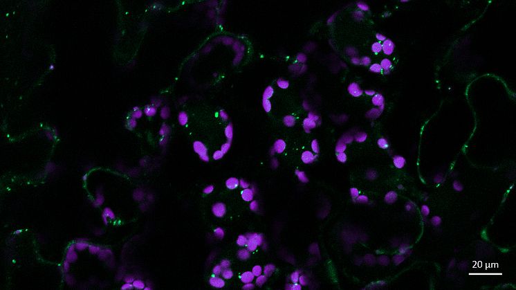 Pseudomonas-infekterade plantor där autofagiska vesiklar märkts med grön fluorescens. Foto: Suayib Üstün