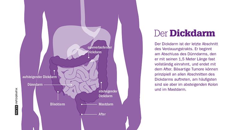 Der Dickdarm. FOCUS Infografik