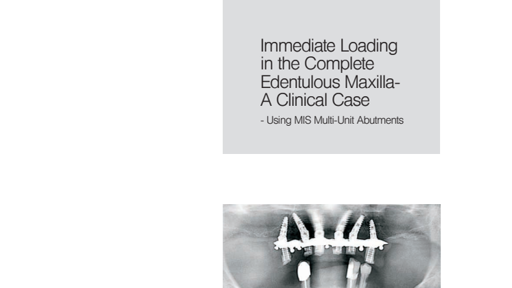 Immediate Loading in the Complete Edentolous Maxilla, A Clinical Case