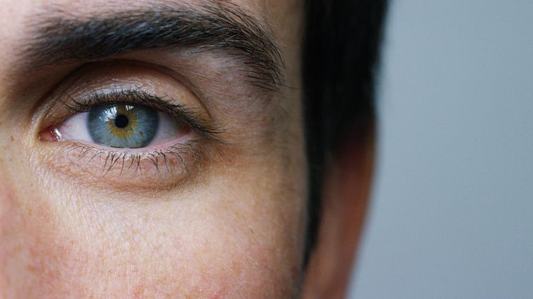 AMD øjensygdom: Behandling med Akupunktur