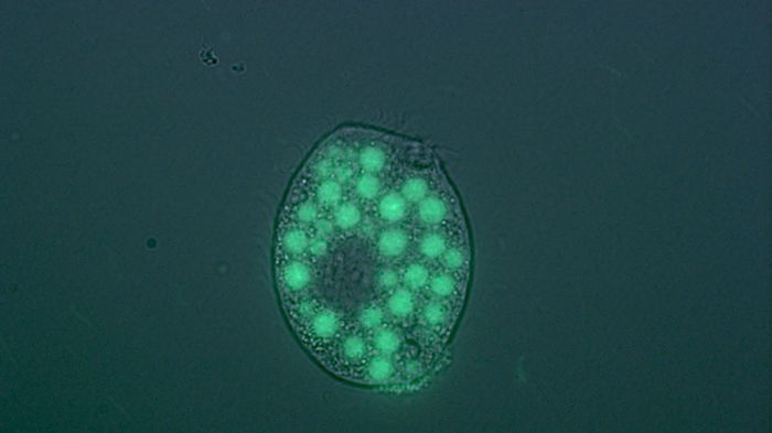En protozo som ätit en stor mängd bakterier. Foto: Johanna Thelaus/FOI