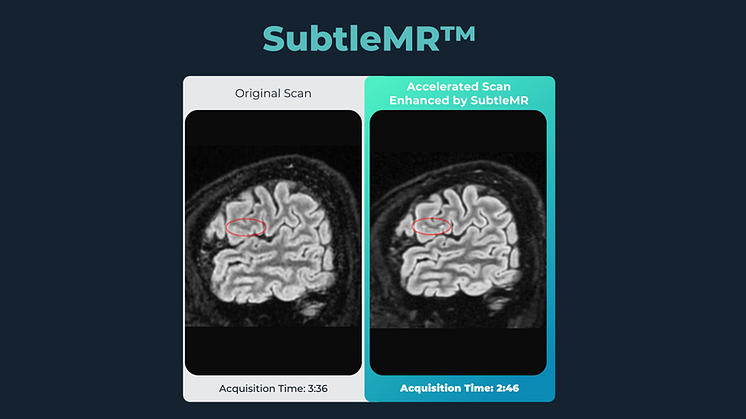 Unilabs Sweden Launches Subtle Medical’s AI-powered Imaging Technology to Further Bolstering Patient Care