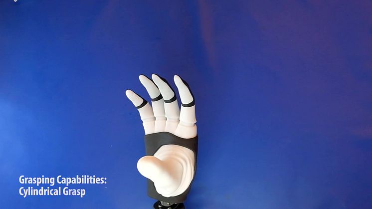 The first dexterous and sentient hand prosthesis