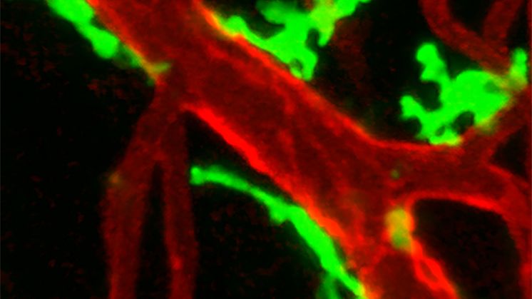 Macrophages (green) accumulate around blood vessels in damaged tissue to regulate blood flow. Credit: David Ahl