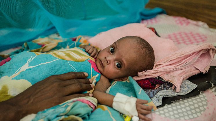 Dahir, sex månader gammal, får behandling på Rädda Barnens mottagning för akut undernärda i Borama, Somaliland. Foto: Colin Crowley/Rädda Barnen 