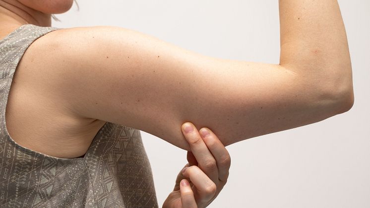 Bingo Wings, Armpit Fat & Accessory Breasts: Why they won’t respond to non-invasive treatments