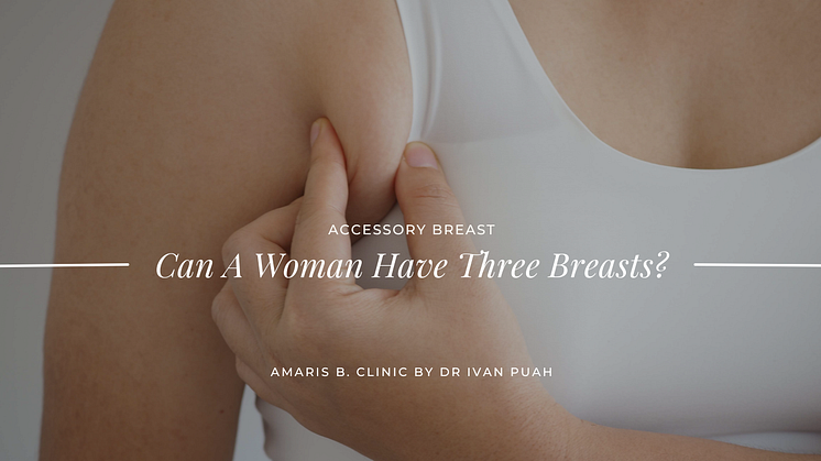 Accessory Breast Can A Woman Have Three Breasts