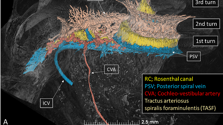 Cochlea blood vessel