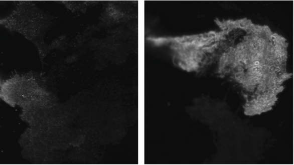 Bilden visar en fluorescensmikroskopbild på brunfettsceller. Vänster: Ostimulerade brunfettsceller. Höger: Stimulerade brunfettsceller där socker går in med hjälp av transportörer (vitt).