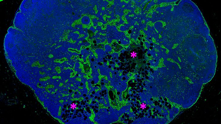 Lymph node with early stage lipomatosis