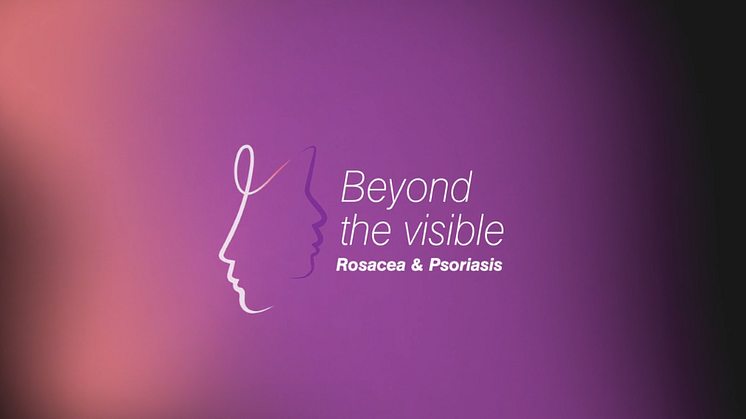 Undersökningen belyser patienternas upplevelser av att leva med rosacea eller psoriasis i ansiktet samt läkarnas behandling av dessa sjukdomar. 