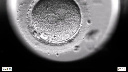 Embryoutveckling via Embryoskop