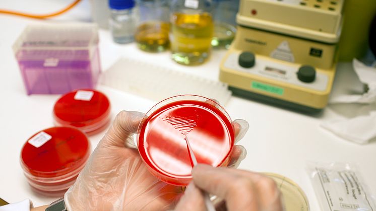 Ny forskning om bakterietoxiner kan leda till bättre strategier för att förebygga sjukdomar. Foto: Elin Berge