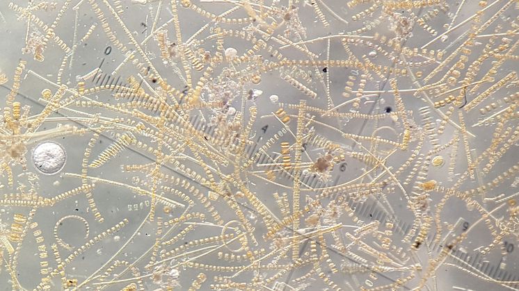 Diatoms sampled during the spring bloom in the Barents Sea. Marine microalgae bind CO2 through photosynthesis, producing organic carbon and oxygen. Photo: Eva Leu/Akvaplan-niva