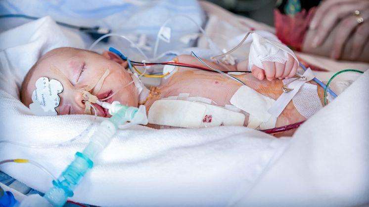 Närbild på liten nyfödd pojke som vårdas på intensivvårdsavdelning på Skånes universitetssjukhus i Lund efter stor hjärtoperation. Mamman syns delvis i bakgrunden. Foto: Mostphotos