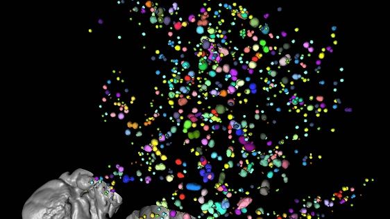Bilden (skapad med OPT-teknik) visar bukspottkörteln från en frisk mus. De enskilda insulinproducerande öarna (Langerhanska öar) är färgkodade. Den exokrina (grå) bukspottkörtelvävnaden har delvis redigerats bort digitalt. Bild: Ulf Ahlgren