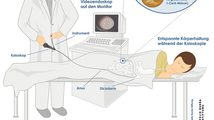 Koloskopie des Dickdarms