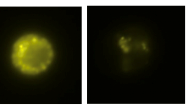 Isolated mast cell progenitor before and after IgE-crosslinking.