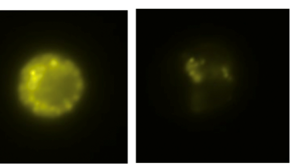 isolerad mastcell före och efter lgE-crosslinking.png