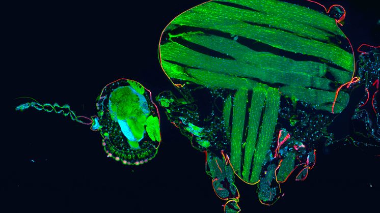 Avsnitt av ett mygghuvud (till vänster) och thorax (till höger), färgat för lokalisering av enskilda immunceller. Foto:  Gianmarco Raddi, Wellcome Sanger Institute