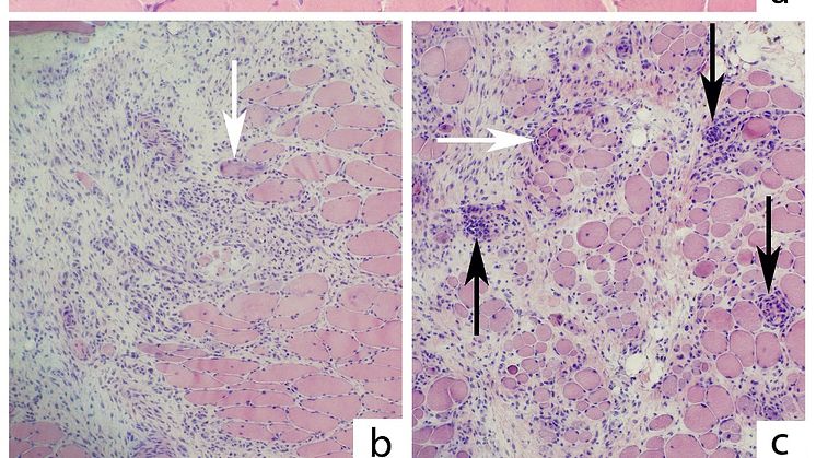 Normal muskelmorfologi hos kontrolldjur (a) där muskelfibrer ligger tätt packade. B och c visar områden med muskelinflammation från experimentdjur och hur vita blodkroppar invaderat in i den lösa bindväven. Bild: Lina Renström.