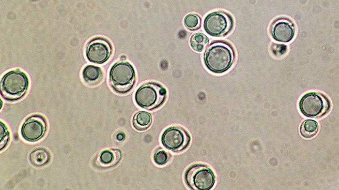 Mikroskopbild av jästceller (Lipomyces starkeyi) som till nästan hälften är fyllda av olja. Foto: Nils Mikkelsen, SLU