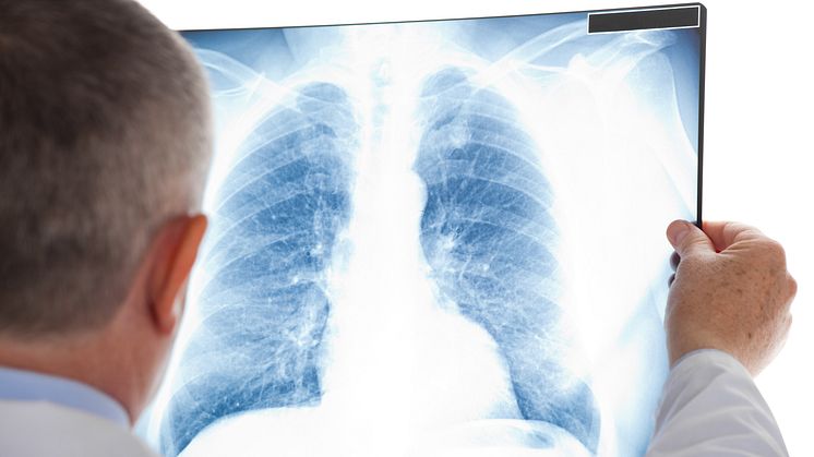 Förhöjda radonhalter i vår inomhusluft är den näst vanligaste orsaken till lungcancer