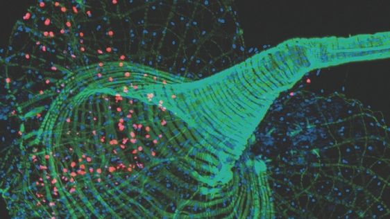 Magen från en bananfluga som infekterats med Noravirus. Cellkärnorna i de virusinfekterade cellerna lyser rött med hjälp av den nya metoden. Cellkärnorna i de oinfekterade cellerna visas i blått och muskelceller i grönt. (Foto: Jens-Ola Ekström).