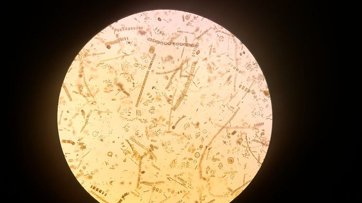 Through a microscope, the stunning diversity of phytoplankton becomes obvious. These specimens were sampled in Van Mijenfjorden during the spring bloom (Photo: Ane Cecilie Kvernvik)