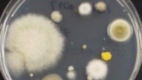 A variety of fungi commonly observed from face masks after a single-day use