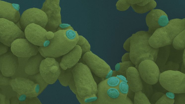 Svepelektronisk foto på jästarten Kluyveromyces som tål mera extrema betingelser (högre temperaturer och andra substrat) än vanlig bagerijäst. Bild från Umeå Center for Electron Microscopy, UCEM. Foto: Cheng Choo Lee, Baraa Rehamnia och Natuschka Lee