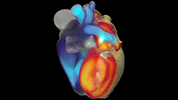 iHEART Simulator, a mathematical model of the heart to revolutionise cardiac research
