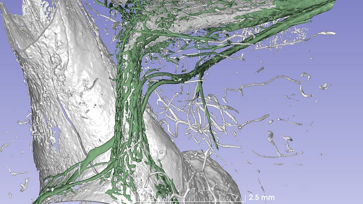 A synchrotron X-ray of the balance organ of the human inner ear.