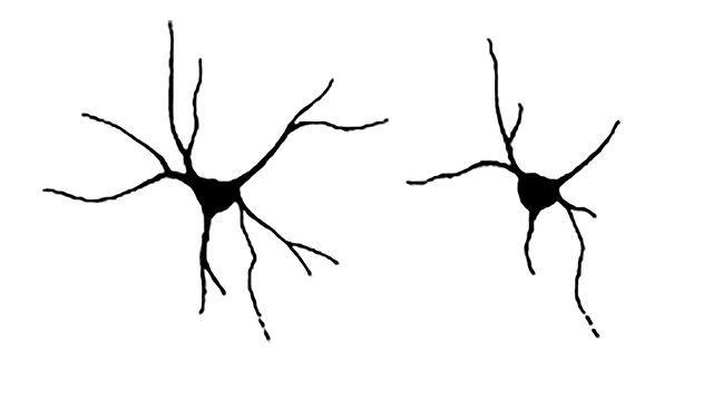 Till vänster en normalt utvecklad nervcell, i jämförelse med en nervcell som saknar neurchondrin, till höger, med färre och kortare utskott.