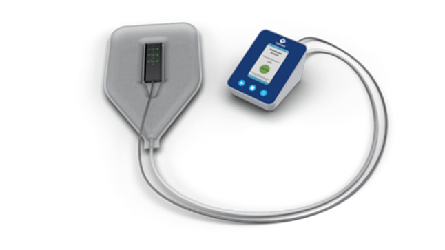 PU sensors teknik möjliggör objektiva riskbedömningar för trycksår genom photopletysmografi. Deras CE-märkta produkt och metod för att förebygga trycksår är nu färdig att användas inom sjukvård och äldreomsorg.