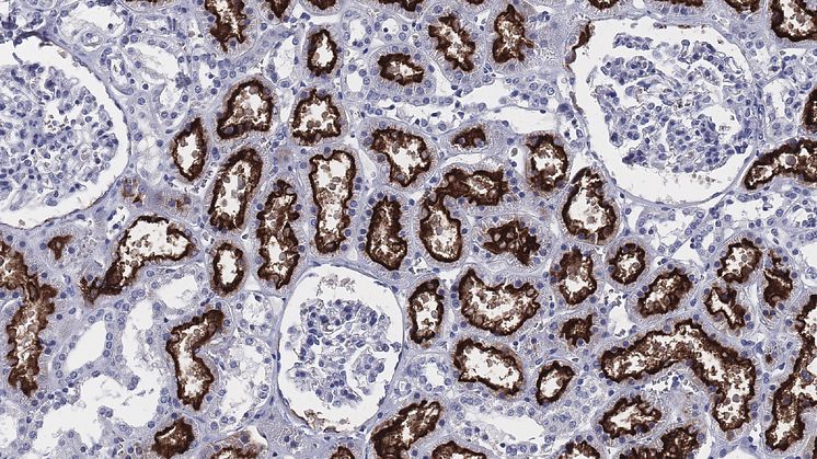 Bilden visar hur enzymet ACE2 (brunfärgat) uttrycks i njuren. Forskarna har kartlagt det celltypspecifika uttrycket av ACE2 i mer än 150 olika mänskliga celltyper. Foto: Human Protein Atlas