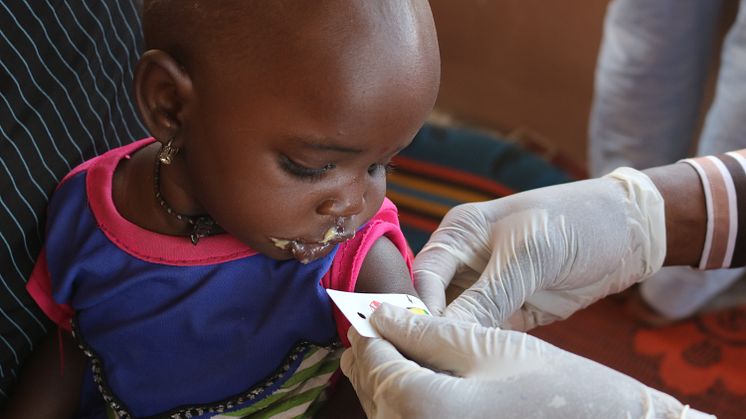 Ettåriga Aisha får behandling mot undernäring vid ett sjukhus i nordöstra Nigeria som arbetar med stöd från Rädda Barnen. *Namnet är fingerat och bilden publiceras med tillåtelse från Aishas familj.
