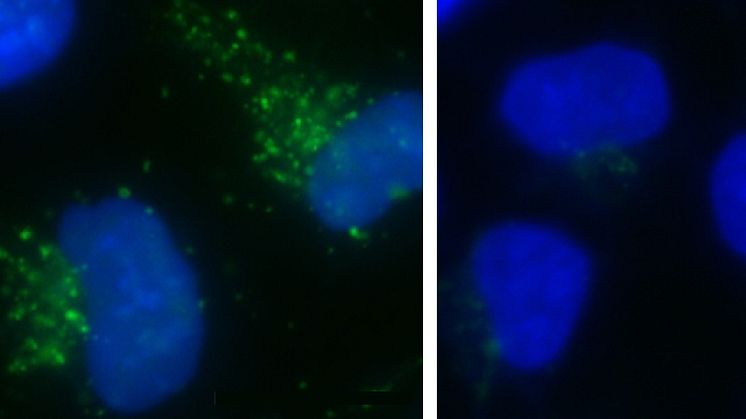 Protein som kan ge oss längre liv identifierat?