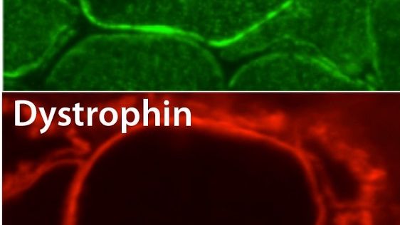 Proteinerna Wnt7a (bild a) och dystrofin (bild B) i en muskelfibrer (i extremitetsmuskel) hos en djurmodell. De immunfärgade proteinerna är sammanslagna i bild C, som visar hur Wnt7a finns inuti muskelfibrernas cellmembran.